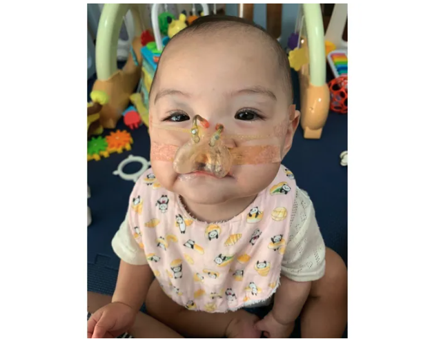 「このお口、見れなくなるの少し寂しい」。口唇口蓋裂の子を育てる母の想いと治療とは？～新生児医療の現場から～【新生児科医・豊島勝昭】