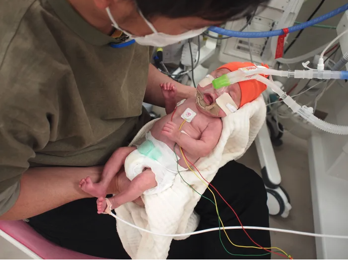 妊娠23週4日で破水し､翌日緊急帝王切開で生まれた長男｡639gの小さな体に次々に襲いかかる試練･･･「生きて」と願い続けた【超低出生体重児】