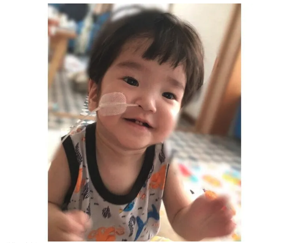 先天性の食道閉鎖でミルクが飲めない状態で誕生､生後すぐに8時間を超える手術をした赤ちゃん～新生児医療の現場から～【新生児科医･豊島勝昭】