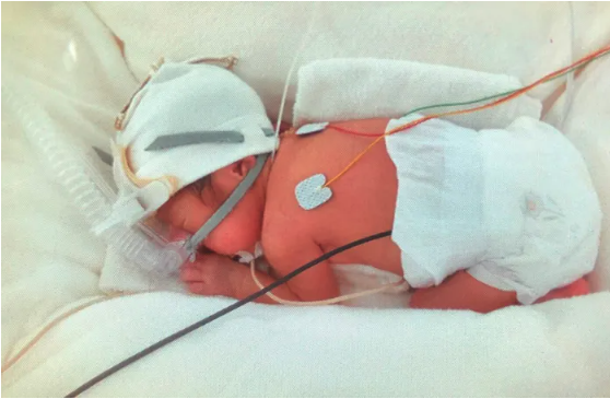 妊娠23週で気づいた少量の出血。実は母体が危険な状態だった…。「絶対に無事に産んで、家族5人で笑って過ごす」母の思い【極低出生体重児】